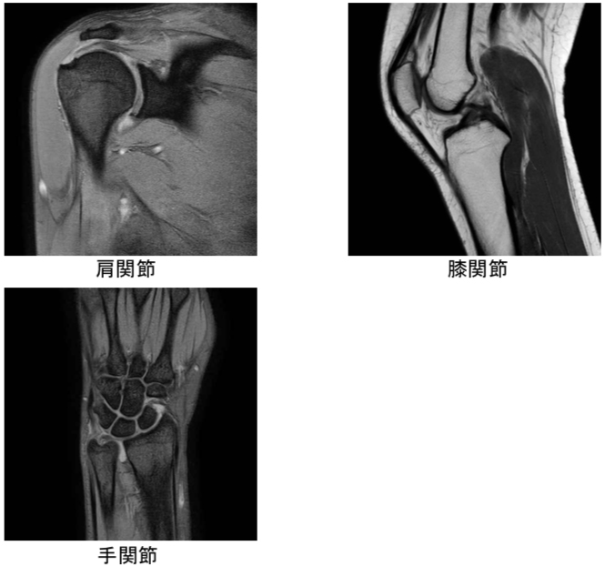 撮影画像