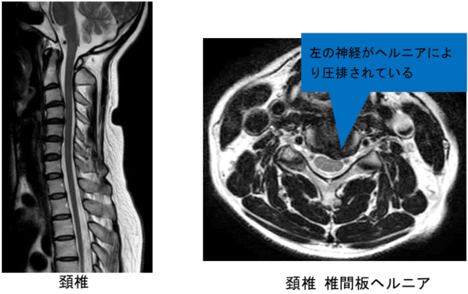 撮影画像