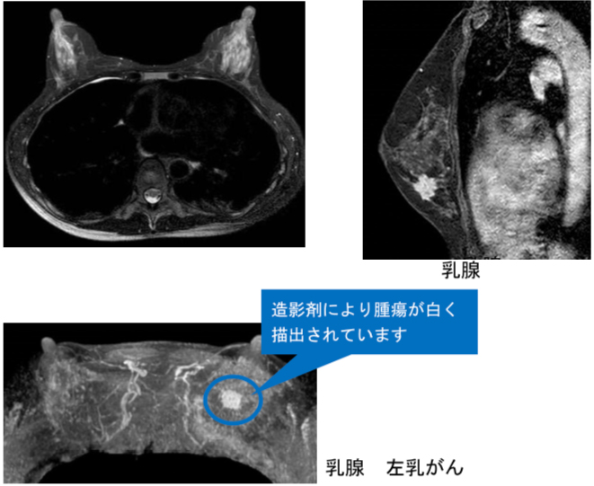 撮影画像