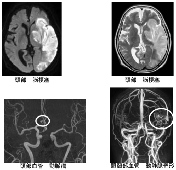 撮影画像